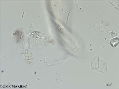 phyto/Scattered_Islands/iles_glorieuses/SIREME May 2016/Diatoma sp2 (cf Diatoma vulgaris -SIREME-Glorieuses2016-GLO5surf-51016-centrique de profil-4)(copy)_thumb.jpg